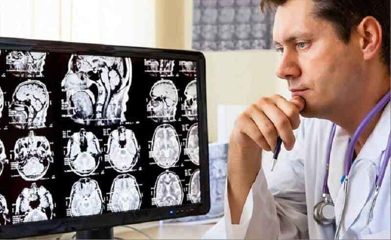 هشدار تازه؛ مغز مردان زودتر تحلیل می‌رود